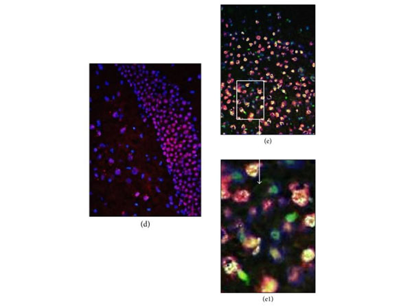Immunofluorescence using Streptavidin Phycoerythrin